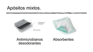 Apósitos mixtos.
Antimicrobianos
desodorantes
Absorbentes
 