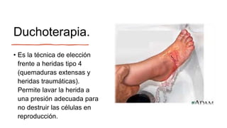 Duchoterapia.
• Es la técnica de elección
frente a heridas tipo 4
(quemaduras extensas y
heridas traumáticas).
Permite lavar la herida a
una presión adecuada para
no destruir las células en
reproducción.
 