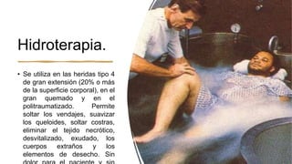 Hidroterapia.
• Se utiliza en las heridas tipo 4
de gran extensión (20% o más
de la superficie corporal), en el
gran quemado y en el
politraumatizado. Permite
soltar los vendajes, suavizar
los queloides, soltar costras,
eliminar el tejido necrótico,
desvitalizado, exudado, los
cuerpos extraños y los
elementos de desecho. Sin
 