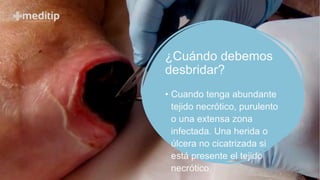 ¿Cuándo debemos
desbridar?
• Cuando tenga abundante
tejido necrótico, purulento
o una extensa zona
infectada. Una herida o
úlcera no cicatrizada si
está presente el tejido
necrótico.
 