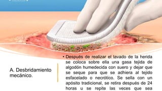 A. Desbridamiento
mecánico.
• Después de realizar el lavado de la herida
se coloca sobre ella una gasa tejida de
algodón humedecida con suero y dejar que
se seque para que se adhiera al tejido
esfacelado o necrótico. Se sella con un
apósito tradicional, se retira después de 24
horas u se repite las veces que sea
 