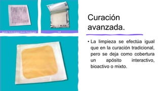 Curación
avanzada.
• La limpieza se efectúa igual
que en la curación tradicional,
pero se deja como cobertura
un apósito interactivo,
bioactivo o mixto.
 