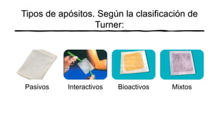 Tipos de apósitos. Según la clasificación de
Turner:
Pasivos Interactivos Bioactivos Mixtos
 