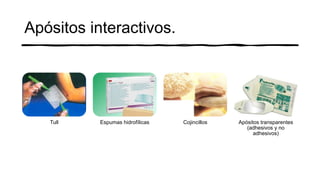 Apósitos interactivos.
Tull Espumas hidrofílicas Cojincillos Apósitos transparentes
(adhesivos y no
adhesivos)
 