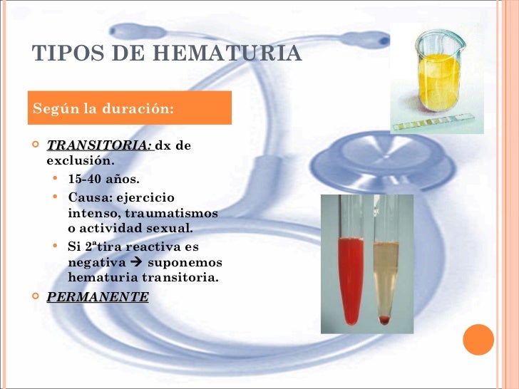 Manejo de la hematuria en atención primaria (1)