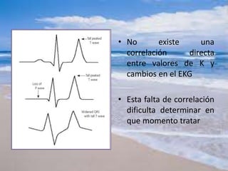 • No existe una
correlación directa
entre valores de K y
cambios en el EKG
• Esta falta de correlación
dificulta determinar en
que momento tratar
 