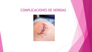 COMPLICACIONES DE HERIDAS
 