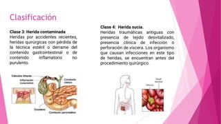 Clasificación
Clase 3: Herida contaminada
Heridas por accidentes recientes,
heridas quirúrgicas con pérdida de
la técnica estéril o derrame del
contenido gastrointestinal o de
contenido inflamatorio no
purulento.
Clase 4: Herida sucia.
Heridas traumáticas antiguas con
presencia de tejido desvitalizado,
presencia clínica de infección o
perforación de víscera. Los organismo
que causan infecciones en este tipo
de heridas, se encuentran antes del
procedimiento quirúrgico.
 
