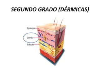SEGUNDO GRADO (DÉRMICAS)
 