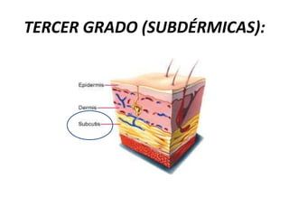 TERCER GRADO (SUBDÉRMICAS):
 