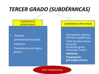 TERCER GRADO (SUBDÉRMICAS)
- Aspecto
carbonáceo/nacarado
- Indoloras
- Tratamiento quirúrgico
precoz
- Sobrepasan espacio
dérmico-epidérmico
- Daño de estructuras
cercanas:
tendones,grasa,
músculos, hueso.
- Indoloras
- Tratamiento
quirúrgico precoz
SUBDÉRMICAS
SUPERFICIALES SUBDÉRMICAS PROFUNDAS
VASO TROMBOSADO
 