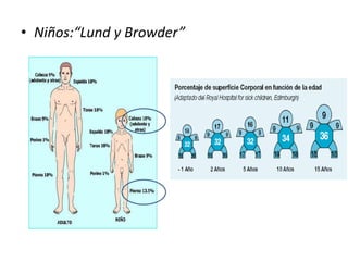 • Niños:“Lund y Browder”
 
