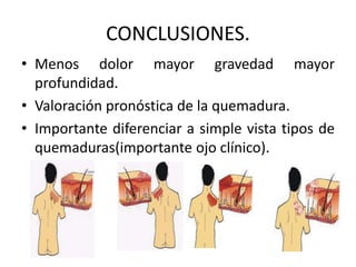 CONCLUSIONES.
• Menos dolor mayor gravedad mayor
profundidad.
• Valoración pronóstica de la quemadura.
• Importante diferenciar a simple vista tipos de
quemaduras(importante ojo clínico).
 