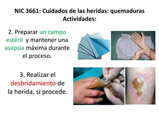 NIC 3661: Cuidados de las heridas: quemaduras
Actividades:
2. Preparar un campo
estéril y mantener una
asepsia máxima durante
el proceso.
3. Realizar el
desbridamiento de
la herida, si procede.
 