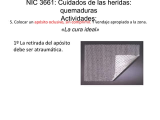 NIC 3661: Cuidados de las heridas:
quemaduras
Actividades:5. Colocar un apósito oclusivo, sin comprimir. Y vendaje apropiado a la zona.
«La cura ideal»
1º La retirada del apósito
debe ser atraumática.
 