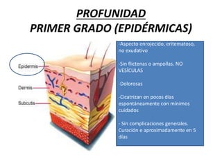 PROFUNIDAD
PRIMER GRADO (EPIDÉRMICAS)
-Aspecto enrojecido, eritematoso,
no exudativo
-Sin flictenas o ampollas. NO
VESÍCULAS
-Dolorosas
-Cicatrizan en pocos días
espontáneamente con mínimos
cuidados
- Sin complicaciones generales.
Curación e aproximadamente en 5
días
 