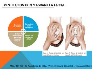 VENTILACION CON MASCARILLA FACIAL
Dominio
de técnica
Garantizar
sello
hermético
Signos de
ventilación
difícil.
Evitar
Ventilación
excesiva
riesgo de
emesis.
Miller RD (2010). Anestesia de Miller (7ma. Edición): Churchill Livingstone/Elsevie
 