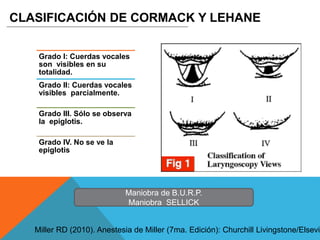 Grado I: Cuerdas vocales
son visibles en su
totalidad.
Grado II: Cuerdas vocales
visibles parcialmente.
Grado III. Sólo se observa
la epiglotis.
Grado IV. No se ve la
epiglotis
CLASIFICACIÓN DE CORMACK Y LEHANE
Miller RD (2010). Anestesia de Miller (7ma. Edición): Churchill Livingstone/Elsevie
Maniobra de B.U.R.P.
Maniobra SELLICK
 