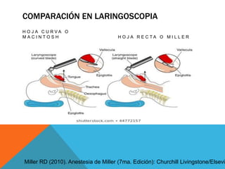 COMPARACIÓN EN LARINGOSCOPIA
H O J A C U R V A O
M A C I N T O S H H O J A R E C T A O M I L L E R
Miller RD (2010). Anestesia de Miller (7ma. Edición): Churchill Livingstone/Elsevie
 