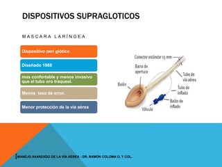 DISPOSITIVOS SUPRAGLOTICOS
M A S C A R A L A R Í N G E A
Dispositivo peri glótico
Diseñado 1988
mas confortable y menos invasivo
que el tubo oro traqueal.
Menos tasa de error.
Menor protección de la vía aérea
[MANEJO AVANZADO DE LA VÍA AÉREA - DR. RAMÓN COLOMA O. Y COL.
 