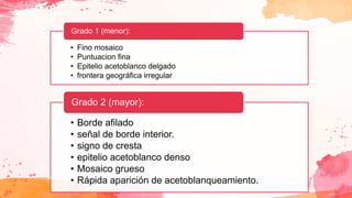 • Fino mosaico
• Puntuacion fina
• Epitelio acetoblanco delgado
• frontera geográfica irregular
Grado 1 (menor):
• Borde afilado
• señal de borde interior.
• signo de cresta
• epitelio acetoblanco denso
• Mosaico grueso
• Rápida aparición de acetoblanqueamiento.
Grado 2 (mayor):
 