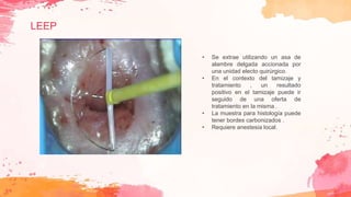 LEEP
• Se extrae utilizando un asa de
alambre delgada accionada por
una unidad electo quirúrgico.
• En el contexto del tamizaje y
tratamiento , un resultado
positivo en el tamizaje puede ir
seguido de una oferta de
tratamiento en la misma .
• La muestra para histología puede
tener bordes carbonizados .
• Requiere anestesia local.
 