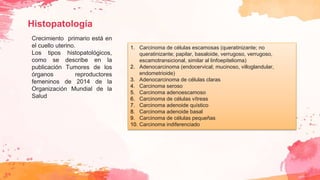 Histopatología
Crecimiento primario está en
el cuello uterino.
Los tipos histopatológicos,
como se describe en la
publicación Tumores de los
órganos reproductores
femeninos de 2014 de la
Organización Mundial de la
Salud
1. Carcinoma de células escamosas (queratinizante; no
queratinizante; papilar, basaloide, verrugoso, verrugoso,
escamotransicional, similar al linfoepitelioma)
2. Adenocarcinoma (endocervical; mucinoso, villoglandular,
endometrioide)
3. Adenocarcinoma de células claras
4. Carcinoma seroso
5. Carcinoma adenoescamoso
6. Carcinoma de células vítreas
7. Carcinoma adenoide quístico
8. Carcinoma adenoide basal
9. Carcinoma de células pequeñas
10. Carcinoma indiferenciado
 