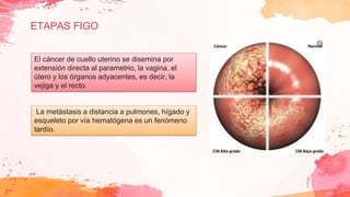ETAPAS FIGO
El cáncer de cuello uterino se disemina por
extensión directa al parametrio, la vagina, el
útero y los órganos adyacentes, es decir, la
vejiga y el recto.
La metástasis a distancia a pulmones, hígado y
esqueleto por vía hematógena es un fenómeno
tardío.
 