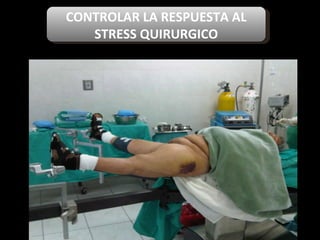 CONTROLAR LA RESPUESTA AL STRESS QUIRURGICO 
