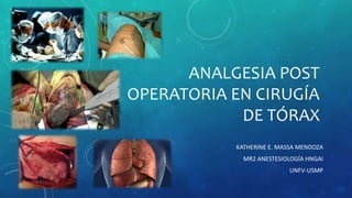 ANALGESIA POST
OPERATORIA EN CIRUGÍA
DE TÓRAX
KATHERINE E. MASSA MENDOZA
MR2 ANESTESIOLOGÍA HNGAI
UNFV-USMP
 
