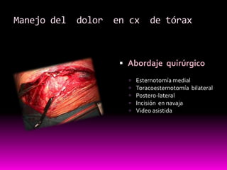 Abordaje  quirúrgicoEsternotomía medialToracoesternotomía  bilateralPostero-lateralIncisión  en navajaVideo asistidaManejo del  dolor  en cx  de tórax