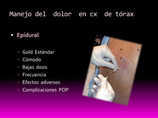 EpiduralGold  Estándar CómodoBajas  dosis FrecuenciaEfectos  adversosComplicaciones  POPManejo del  dolor  en cx  de tórax