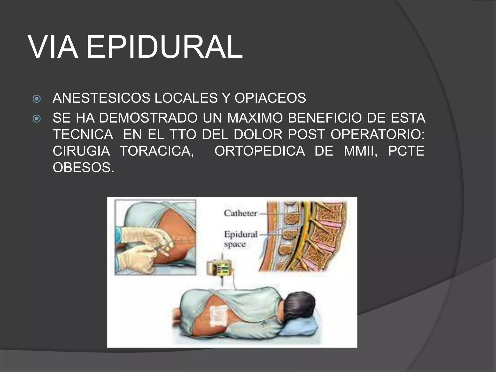 Manejo del dolor post operatorio | PPTX