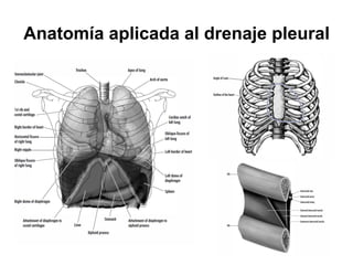 Anatomía aplicada al drenaje pleural
 