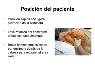 Posición del paciente
• Posición supina con ligera
  elevación de la cabecera

• Leve rotación del hemitórax
  afecto con una almohada

• Brazo homolateral colocado
  por encima y detrás de la
  cabeza para exponer el área
  axilar
 