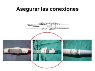 Asegurar las conexiones
 
