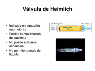Válvula de Heimlich


• Indicada en pequeños
  neumotórax
• Facilita la movilización
  del paciente
• No puede aplicarse
  aspiración
• No permite drenaje de
  líquido
 