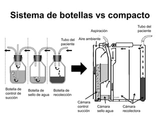 Sistema de botellas vs compacto
                                                                               Tubo del
                                                      Aspiración               paciente

                                 Tubo del   Aire ambiente
                                 paciente




Botella de   Botella de      Botella de
control de   sello de agua   recolección
succión
                                            Cámara
                                            control      Cámara       Cámara
                                            succión      sello agua   recolectora
 