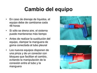 Cambio del equipo
• En caso de drenaje de líquidos, el
  equipo debe de cambiarse cada
  48 horas
• Si sólo se drena aire, el sistema
  puede mantenerse más tiempo
• Antes de realizar la sustitución del
  equipo, clampar la manguera de
  goma conectada al tubo pleural
• Los nuevos equipos disponen de
  una pinza y de un conector con
  bloqueo que facilitan el cambio,
  evitando la manipulación de la
  conexión entre el tubo y la
  manguera
 