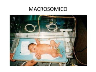 MACROSOMICO 