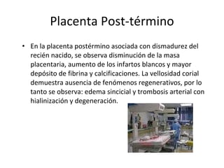 Placenta Post-término En la placenta postérmino asociada con dismadurez del recién nacido, se observa disminución de la masa placentaria, aumento de los infartos blancos y mayor depósito de fibrina y calcificaciones. La vellosidad corial demuestra ausencia de fenómenos regenerativos, por lo tanto se observa: edema sincicial y trombosis arterial con hialinización y degeneración. 