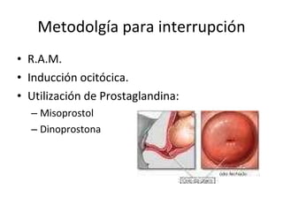 Metodolgía para interrupción R.A.M. Inducción ocitócica. Utilización de Prostaglandina: Misoprostol Dinoprostona 