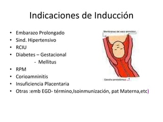 Indicaciones de Inducción Embarazo Prolongado Sind. Hipertensivo RCIU Diabetes – Gestacional -  Mellitus RPM Corioamninitis Insuficiencia Placentaria Otras :emb EGD- término,Isoinmunización, pat Materna,etc ) 