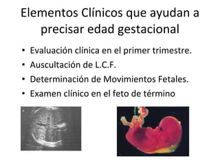 Elementos Clínicos que ayudan a precisar edad gestacional Evaluación clínica en el primer trimestre. Auscultación de L.C.F. Determinación de Movimientos Fetales. Examen clínico en el feto de término 