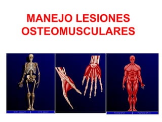 MANEJO LESIONES
OSTEOMUSCULARES
 