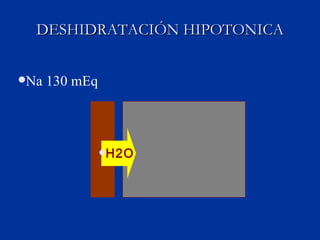 DESHIDRATACIÓN HIPOTONICA H2O Na 130 mEq 