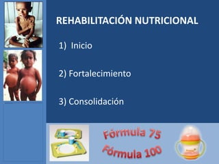REHABILITACIÓN NUTRICIONAL

1) Inicio

2) Fortalecimiento

3) Consolidación
 