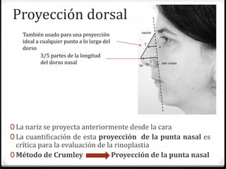 Proyección dorsal
0 La nariz se proyecta anteriormente desde la cara
0 La cuantificación de esta proyección de la punta nasal es
crítica para la evaluación de la rinoplastia
0 Método de Crumley Proyección de la punta nasal
3/5 partes de la longitud
del dorso nasal
También usado para una proyección
ideal a cualquier punto a lo largo del
dorso
 