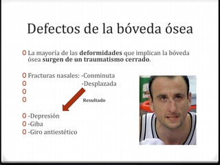 Defectos de la bóveda ósea
0 La mayoría de las deformidades que implican la bóveda
ósea surgen de un traumatismo cerrado.
0 Fracturas nasales: -Conminuta
0 -Desplazada
0
0 Resultado
0 -Depresión
0 -Giba
0 -Giro antiestético
 