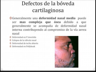 Defectos de la bóveda
cartilaginosa
0 Generalmente una deformidad nasal media puede
ser mas compleja que ósea debido a que
generalmente se acompaña de deformidad nasal
interna contribuyendo al compromiso de la vía aerea
nasal
0 Deformidad en V invertida
0 Colapso de la válvula nasal
0 Deformidad de techo abierto
0 Deformidad en Pollybeak
 